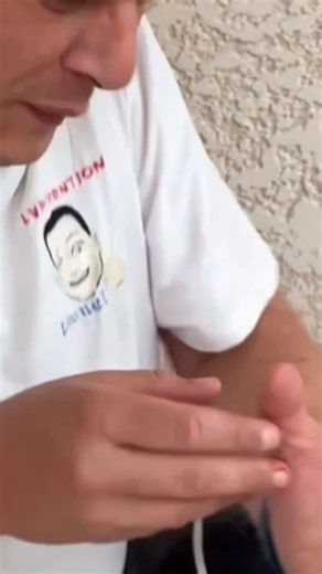 Lionel Ventura on Instagram: "🐍 MORSURE DE SERPENT : NE FAITES SURTOUT PAS ÇA ! Une morsure de serpent, ça peut arriver en balade, au jardin ou en pleine nature… Et pourtant, encore trop de fausses croyances circulent : aspirer le venin, faire un garrot, inciser… 👉 ces gestes peuvent gravement aggraver la situation. Dans cette vidéo, je vous explique quoi ne pas faire et surtout les bons réflexes à adopter immédiatement pour limiter les risques en attendant les secours. 👉 Une information simp