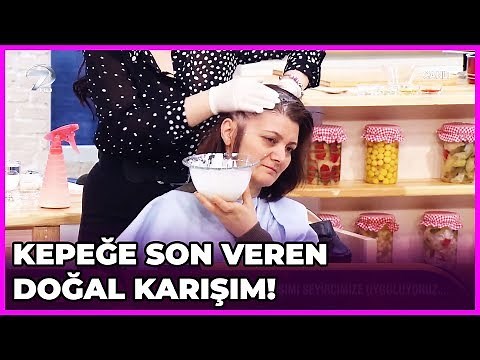 How to Get Rid of Dandruff? | Dr. Feridun Kunak Show | April 1, 2019