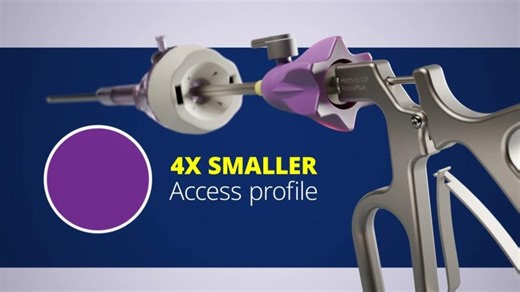 Weck™ Hem-o-lok™ PurplePlus™ Large Polymer Clip Ligation System Demonstration Video I Surgical | Hadi Karanouh