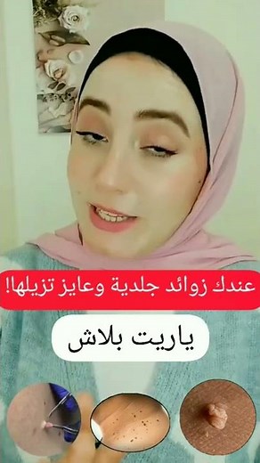 Skin tag removal ❌ #shorts