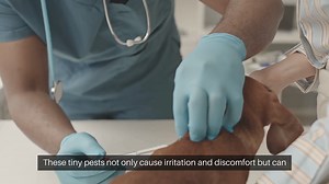 Managing Fleas and Ticks at Home