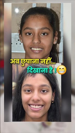 Braces (दांतों में तार) vs Aligner 😱 | Teeth Alignment Best Option | Orthodontic Treatment #braces