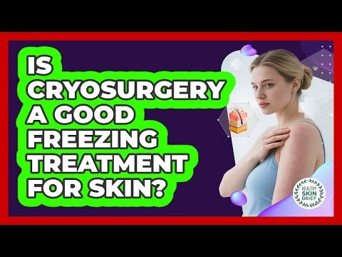 Is Cryosurgery A Good Freezing Treatment For Skin? - Healthy Skin Brief