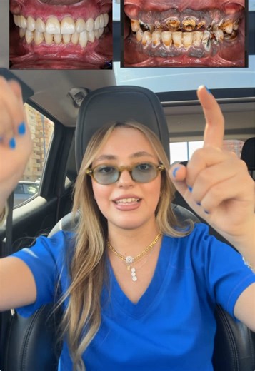 Dental Care Tips from a Professional Dentist