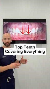 Adult Invisalign Consultation Explaining a Deep Overbite and the Problems it Causes.