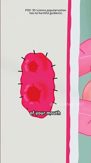 How A Colostomy Bag Works(3D Animation)