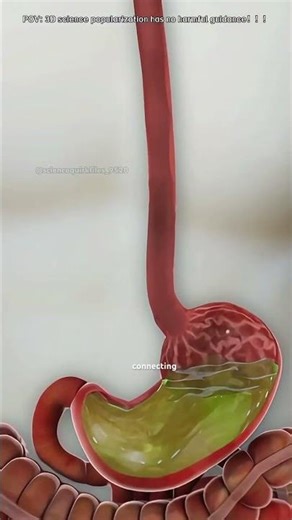 How Incisionless Fundoplication Surgery Is Performed ？#gerd#3dmedicalanimation#medical3danimation