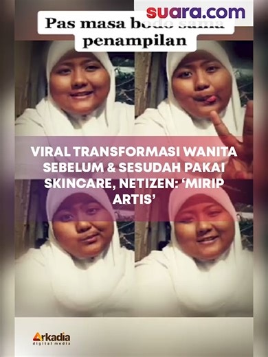 378K views · 924 reactions | Potret Glow Up Wanita Setelah Rutin Pakai Skincare Viral TikTok. Sebuah video transformasi wanita sebelum dan setelah menggunakan produk skincare viral menjadi sorotan di TikTok. | Suaradotcom | Facebook