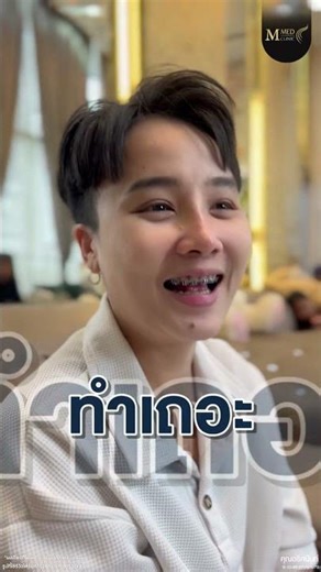 หลังเสริมจมูก + รองปลายเนื้อเยื่อเทียม 14 วัน