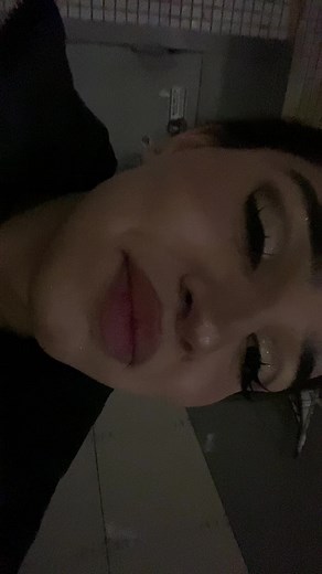 Braces Colors and Combinations Explained