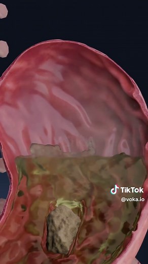 Understanding Bloating: Exploring Digestive Health in 3D