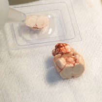 Video: Stereotactic Atlas-Guided Laser Capture Microdissection of Brain Regions Affected by Traumatic Injury