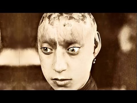 The DISTURBING History of Asylums & Mental Health