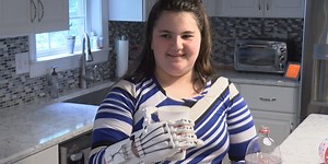 Virginia Tech team creates 3-D printed prosthetic hand for Salem girl with birth defect