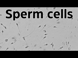 Sperm cells under MICROSCOPE 🔬