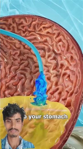 How A Nasal Feeding Tube Works😨