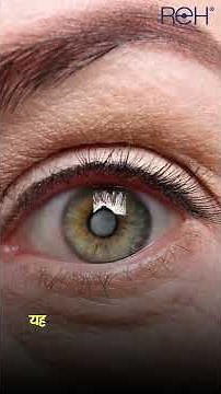 5 essential eye tests everyone should undergo every year