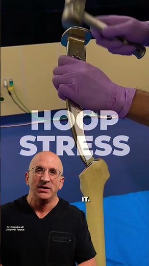 How a Hip Implant Stays in Place Without Cement