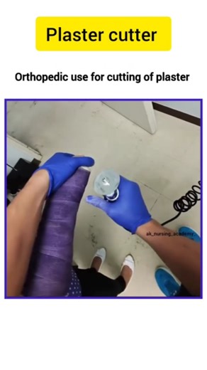 Nursing TV on Instagram: "A plaster cutter, or cast saw, is a medical device that uses a rapidly oscillating or vibrating blade to safely remove orthopedic casts made from plaster of Paris (POP), fiberglass, and other synthetic materials. The blade's vibration cuts through the hard material without harming a patient's skin, which is flexible enough to move with the vibrations. #nursing #medical ##explorepage #bscnursing #nurse #explore #neet #viralnow #trending #trendingreels #viralpost #fy"
