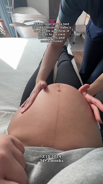 Monitoring Baby's Heart: NST Test During Pregnancy