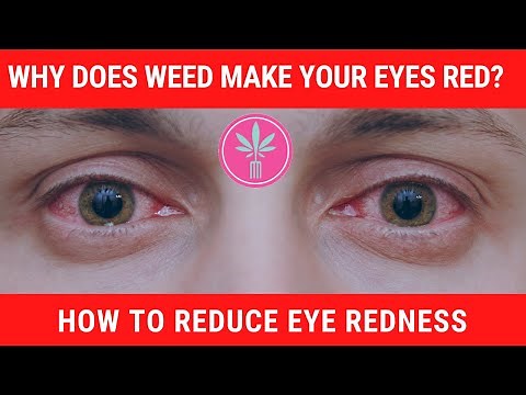 Why Does Marijuana Cause Red Eyes
