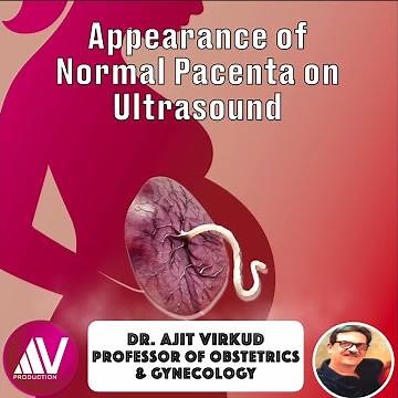 Placental Grading on Ultrasound Examination