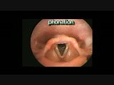 Laryngeal Movements • Video • MEDtube.net