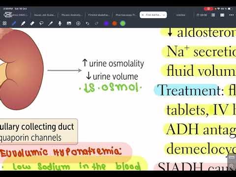 (11)SIADH,Primary polydipsia and diabetes insipedus