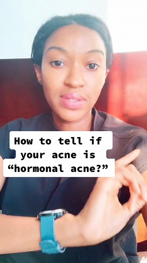 How to tell if your acne is “hormonal acne” #acne #dermatologist #boardcertifieddermatologist #pcos #hormonalacne
