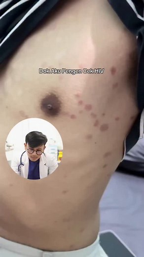 Heri Kurniawan | Riwayat hubungan seksual tdk aman 2 bulan lalu, kemudian muncul ruam kemerahan seperti ini di badan dan tangan (telihat di video), ga tau... | Instagram