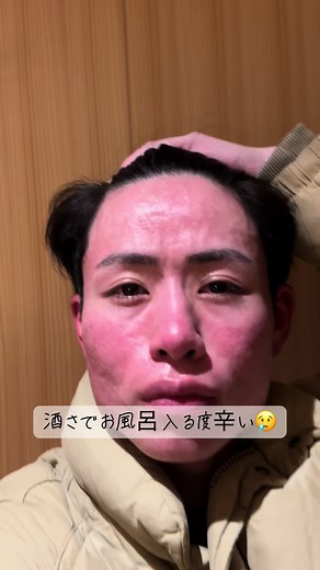 酒さと戦う大学生の美容法
