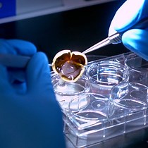Method to Separate Retinal Pigment Epithelium - JoVE Journal