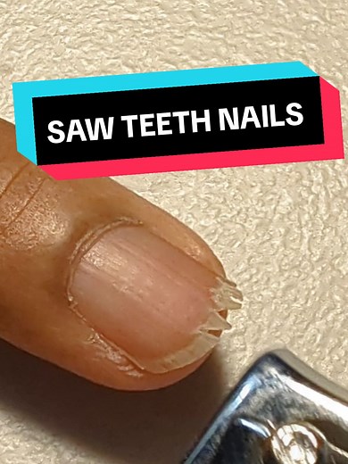 Effective Nail Cutting Techniques for Long Nails