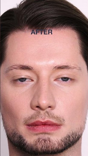 How to Cover Redness/Rosacea