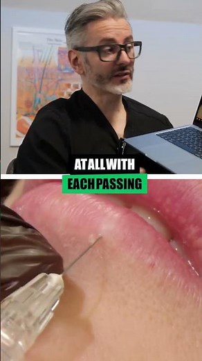 The correct way to do vertical lip injections