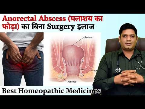 Anorectal Abscess (Malashay ka Phoda) Homeopathic Treatment & Medicines by Dr Sunil Patidar