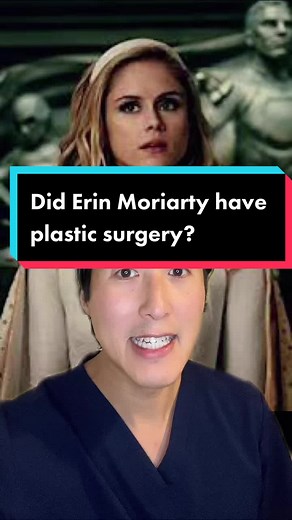 Did Erin Moriarty (Starlight) have plastic surgery? #starlight #erinmoriarty #theboys #theboystv #plasticsurgery