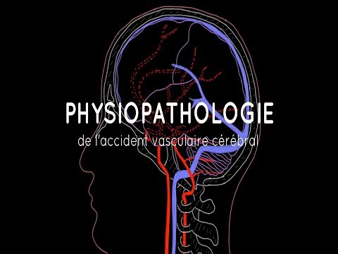 Physiopathologie de l'accident vasculaire cérébral