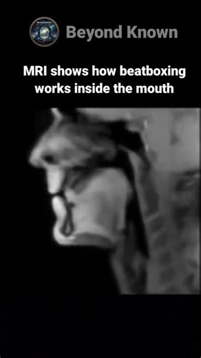 MRI showing beatboxing
