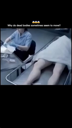 curiosity.on.peek on Instagram: "The leg movements of the corpse seen in the video are not actually a sign of rebirth, but rather a natural reaction of the body after death. When a person dies, the brain has indeed stopped functioning, but the muscles still retain a small amount of electrical energy. This residual energy can cause the muscles to suddenly twitch, flex, or move slightly even though the person is no longer alive. This phenomenon is called the postmortem reflex, and it often surpris