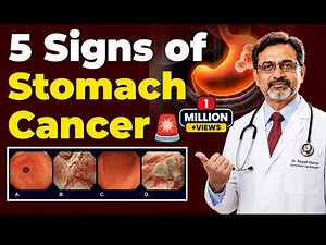 Warning Signs of Stomach Cancer You Shouldn’t Ignore | Symptoms, Diagnosis & Awareness