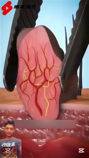 WARNING! Don’t Remove a Skin Tag at Home 🚫"😱