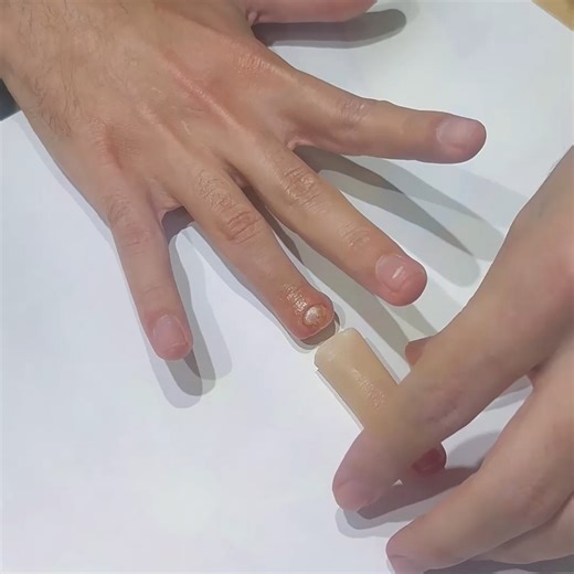 Siliconefinger on Instagram: "Silicrafts® focus on create high-quality, lifelike of Prosthetic Finger, Prosthetic Toe & Prosthesis products only from $199.| support distributor & wholesale #Prosthetic Finger #Prosthesis Finger #Prothesis Finger #Silicone Prosthetic #Prosthetic #Prosthesis #prothesisteongulaire"