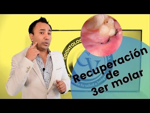 How long does it take for a tooth extraction to heal?