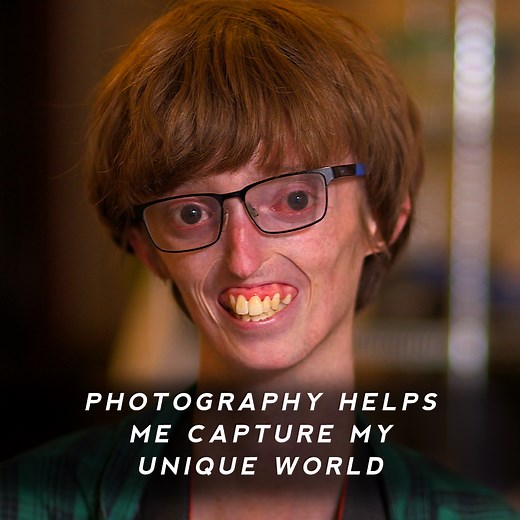 774K views · 10K reactions | "It's important to be yourself because there's no one else like you." Teenage photographer Dylan Lombard doesn’t go anywhere without his camera. | BBC Scotland | Facebook