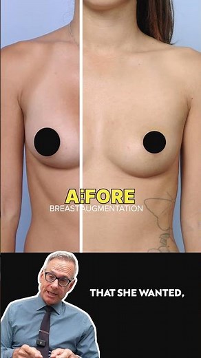 Breakdown | Breast Augmentation with Dr. George Orloff