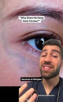 POV: Your Child Has Dark Circles