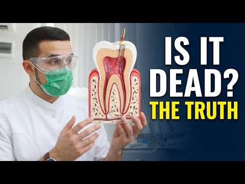 Does a Tooth Die After a Root Canal? The Truth Explained