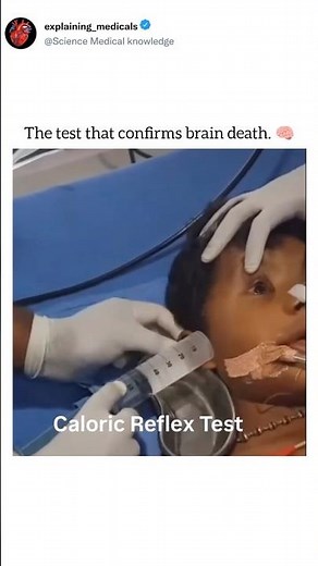 The test that confirms brain death 🧠#doctorlife #trending #viral #shortvideo #nurse #medical
