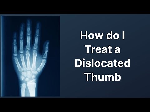 How do I Treat a Dislocated Thumb